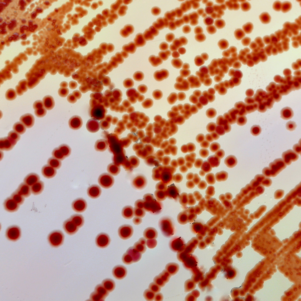 Gut Health is the Foundation: Belly Biotics™ 101